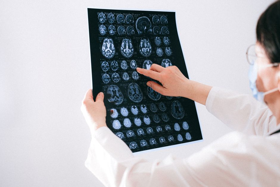 How Much Can You Get for a Brain Injury?